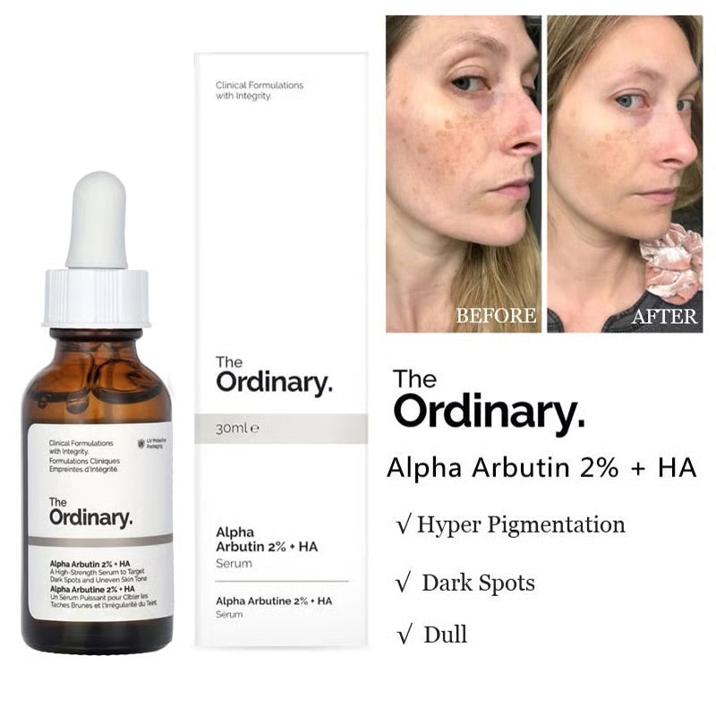 THE ORDINARY ALPHA ARBUTIN 2% HA